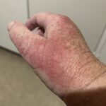 afterchemo_483170_03